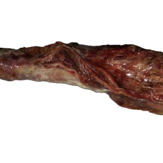 Turkey Neck